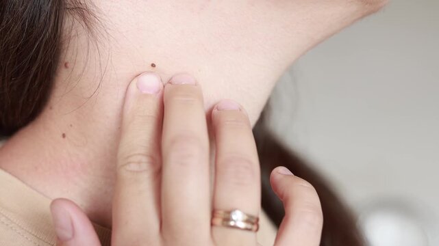 Close up slow motion Caucasian woman touches skin papilloma on neck with hand. Medical dermatology concept shows skin texture and detail.