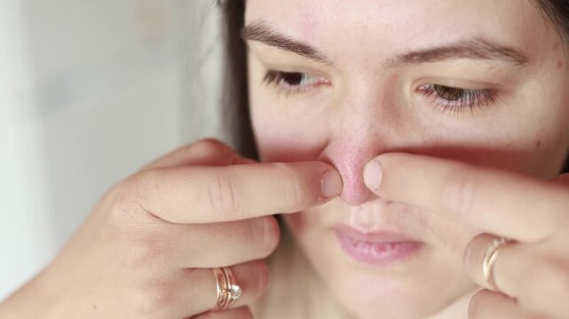 Caucasian woman touches nose with fingers showing blackheads and sebaceous filaments. Close up in slow motion. Problem skin and neglected nails reveal poor self care.