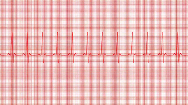 Electrocardiogram of Healthy Heartbeat: A close-up view of a red electrocardiogram (ECG) showing a regular and healthy heartbeat pattern, displayed on a grid paper background.