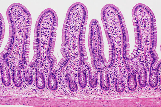 Histological cross-section of intestinal villi displaying mucosal architecture under a microscope.