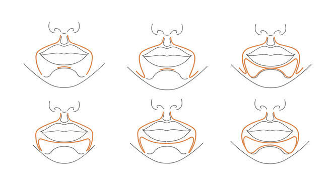Vector illustration of female jaw and chin shape variations. Set of six anatomical line drawings showing lower face profiles, nasolabial folds, and mandible contours for aesthetics.
