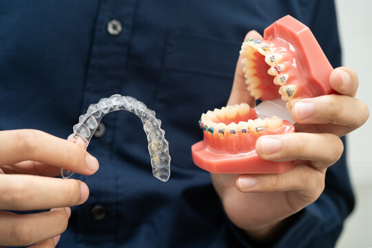 Man holding invisible aligner orthodontic retainer for dental teeth straightening.