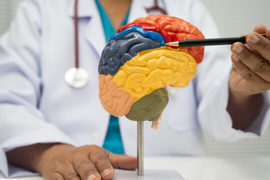 Alzheimer disease, Asian doctor holding brain anatomy model for study diagnosis and treatment in hospital.