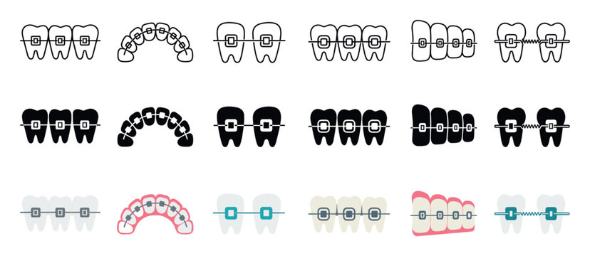 Dental braces and orthodontic teeth icons set showing various types of brackets and wires for dental alignment and correction in three different design styles