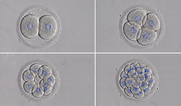 Stages of early embryonic development and cell division.