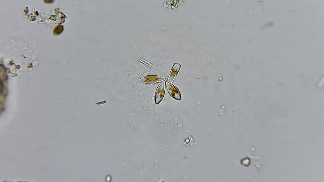 Microscopic view of Diatom algae colony and bacteria in fresh water