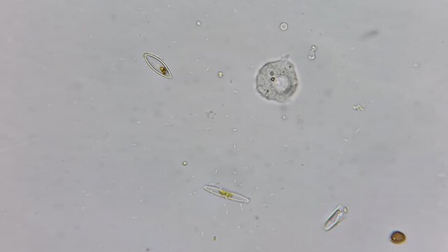 Microscopic view of Amoeba, Diatom algae, and bacteria in pond water drop