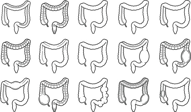 Vector set of human colon disease line icons medical illustration of large intestine disorders and gut health isolated on white background