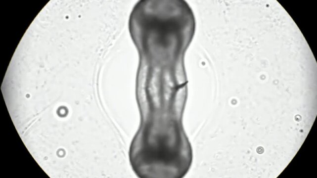 A black and white microscopic view showing dark debris, cells, and fibers floating inside a circular microscope lens field.

