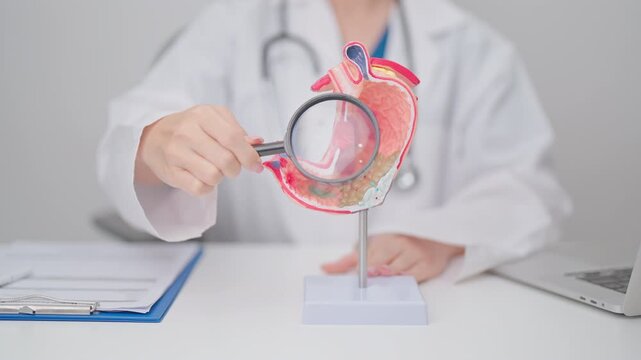 Doctor with Gastric anatomy model. Gastroenterologist consultation, stomach diseases and ulcers, November stomach cancer, Gastroesophageal Reflux Disease, GERD, Acid reflux and healthcare medical