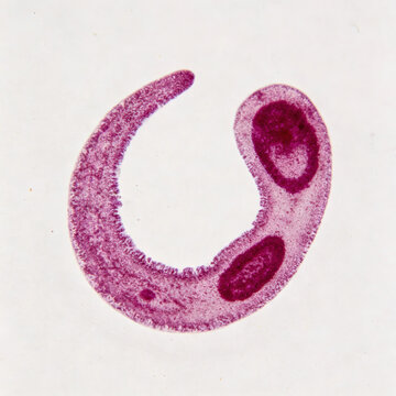 Giemsa-stained *Trypanosoma cruzi* trypomastigotes in a primary blood smear, displaying the characteristic "C" shape; a genuine Chagas disease sample.