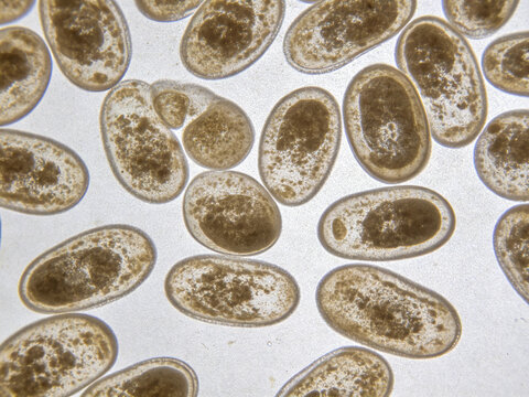 Original Gram-stained photomicrograph of *Haemophilus influenzae* type b (Gram-negative coccobacillus; encapsulated clinical isolate).