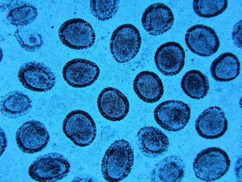 Original GMS-stained image of *Pneumocystis jirovecii* cysts, showing characteristic black, cup-shaped cysts against a blue background.