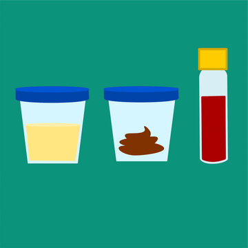 stool sample urine sample and blood sample for lab test concept.eps