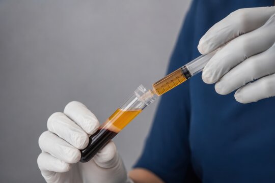 PRP Vial Platelet Rich Plasma Syringe Drawing Golden Plasma From Blood Tube Regenerative Medicine Aesthetic Treatment Hair Restoration Orthopedic Therapy Clinical Procedure Healthcare Medical Concept