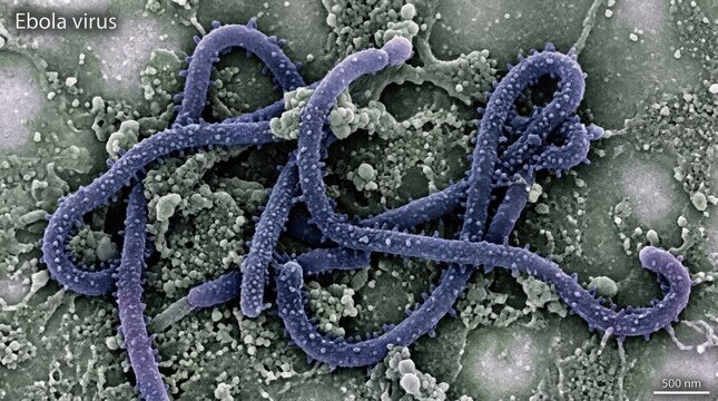 Electron microscope view of ebola virus filaments on contaminated cell culture surface lab.