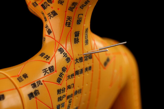 Traditional Chinese Acupuncture Model with Meridian Points and Needles for Ancient Medicine Education