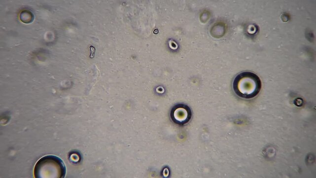 Butter under microscope: Fat globules and emulsion structure