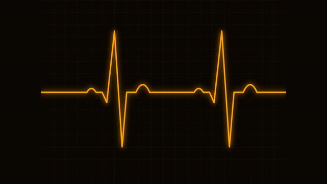 heartbeat flatline electrocardiogram vintage amber orange telemetry waveform sweep animation for retro clinical equipment display 4k