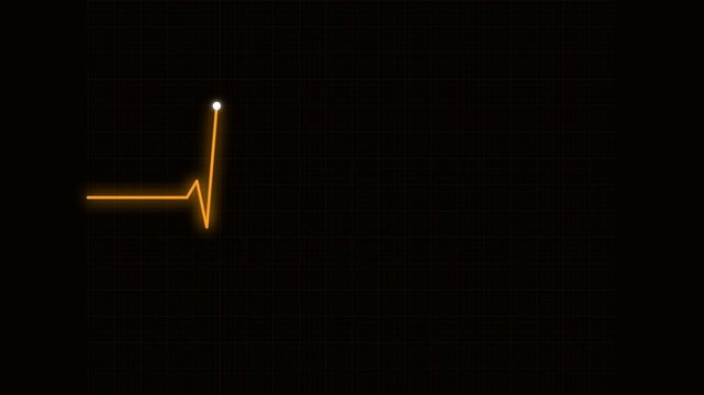 heartbeat flatline electrocardiogram scanning amber alert wave on intensive care monitor grid 4K loop