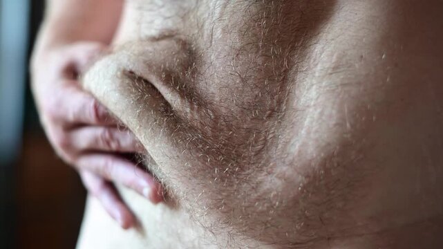 Stomach loos skin after weight lose body hair, close up selective focus background bokeh video