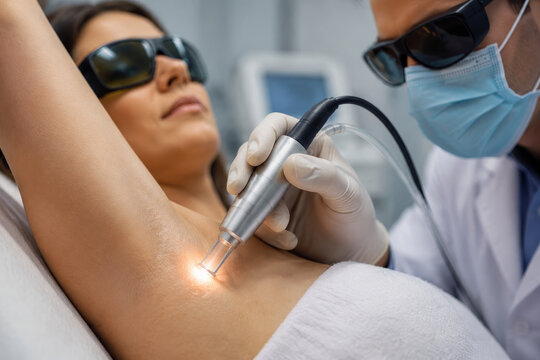 Dermatologist performing laser treatment for hyperhidrosis on female patient armpit. Medical procedure for excessive sweating reduction in aesthetic clinic. Modern skincare technology.