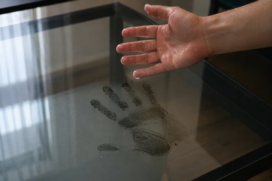 Man with hyperhidrosis leaving damp handprint on glass table. Excessive sweating condition and medical dermatology symptom. Health problem requiring treatment and clinical diagnosis.