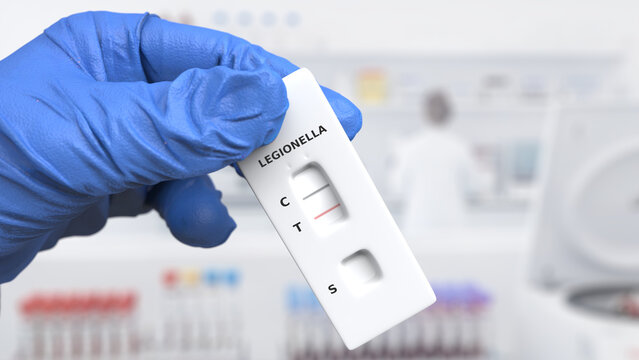 Urinary antigen test (UAT) is the primary and fastest method for diagnosing legionellosis. A positive result