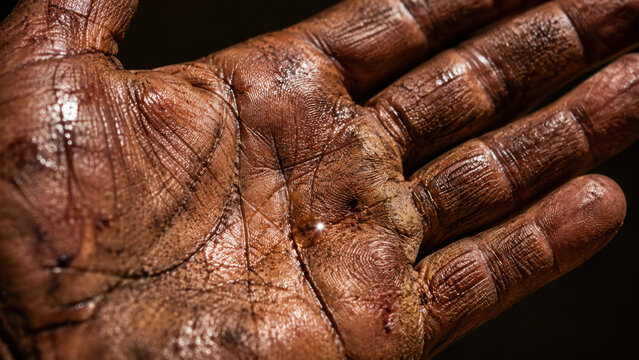 Weathered hand shows signs of hard work and resilience, reflecting heat and stress from labor