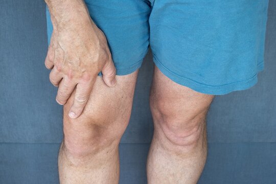 A man holding his right knee with his right hand, wearing short blue shorts, representing joint or muscle pain, injury, illness and medical symptoms.