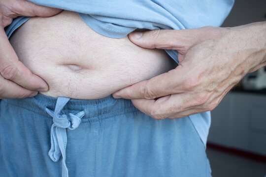 Middle-aged man accumulating abdominal fat due to excessive calorie intake, accumulation of abdominal fat, metabolic disorders, and obesity.
