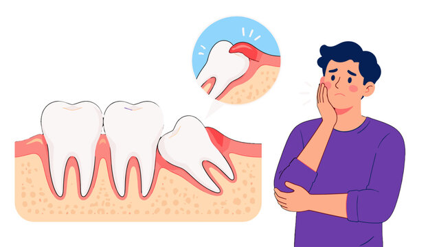 Wisdom tooth pain and impacted molar dental vector illustration