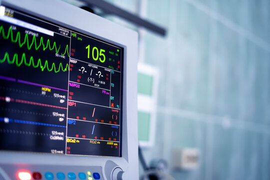 heart monitor screen in the hospital room