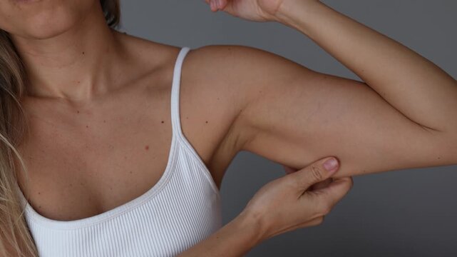 Young woman touches and pinches loose skin on her upper arm, showing body changes after weight loss, sagging skin, soft muscles, excess fat and body insecurity in a wellness concept on grey background