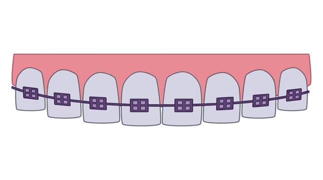 Dental braces with brackets and wire flat vector illustration