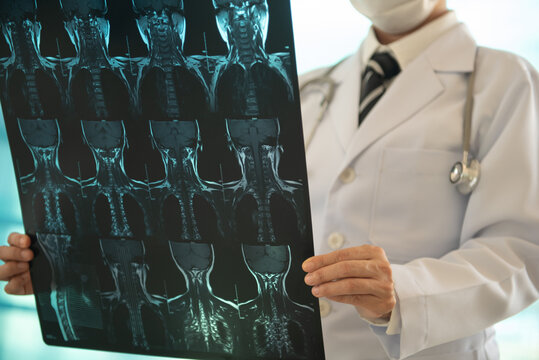 Orthopedist diagnose cervical spondylosis from cervical spine x-ray film by CT Scans or MRI.