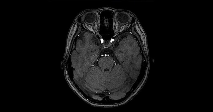 brain mri scan or x-ray images brain by ct scan.