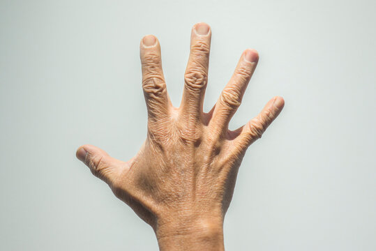 Hands of senior people on white background. Health care concept.