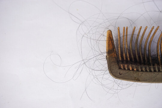 close up of clumps of hair strands caught between the teeth of a plastic comb, which generally represents hair shedding