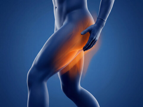 Anatomical illustration of hamstring and glute muscle pain
