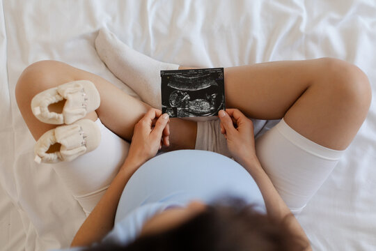Pregnant lady looking at her baby sonography, enjoying future motherhood with first photo of her unborn child and tiny shoes, top view