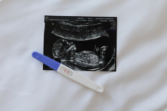 Pregnancy test and fetal ultrasound photo on soft white bedding, representing early pregnancy, maternal health, fertility and anticipation of new family member
