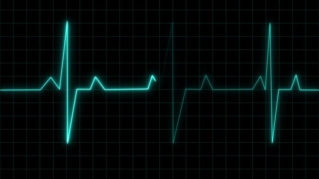 Glowing heart monitor line on a dark grid screen, showing a steady heartbeat rhythm. Clean medical background for health, emergency, hospital, and technology themes.