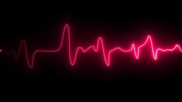 Electrocardiogram graph displaying heartbeat rhythm on digital screen with grid pattern in medical monitoring environment