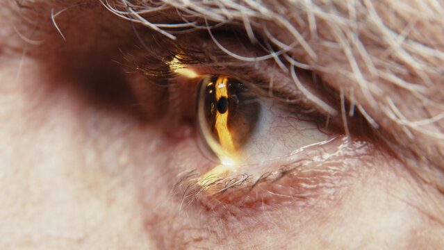 Senior male patient undergoing eye examination with slit lamp, close-up view of eye showing detailed iris and reflection of equipment in the pupil