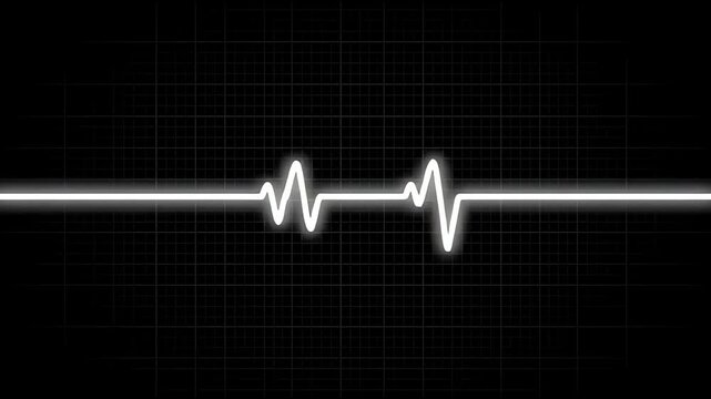 A glowing electronic signal visualizes rhythmic pulsations across a dark medical monitoring screen display to signify ongoing heart activity within a clinical setting during emergency cardiac
