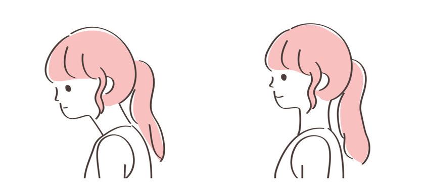 ストレートネック（スマホ首）と正常な状態の首の比較イラスト