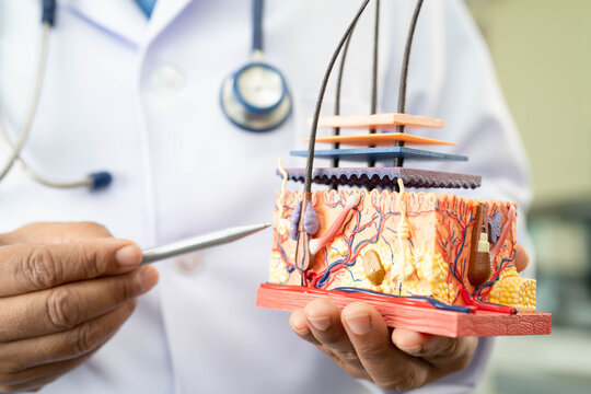 Hair transplant, Asian dermatologist doctor holding skin structure anatomy model for treatment in hospital.