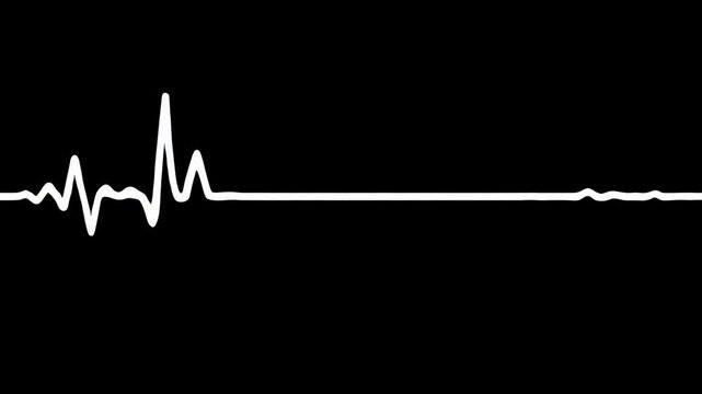 A digital representation shows the rhythmic electrical activity within human cardiac tissue as recorded by medical equipment during a critical emergency procedure to monitor vital signs