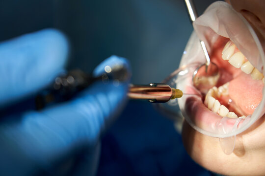 Dentist making local anesthesia shot before surgery. Patient visiting a dental office